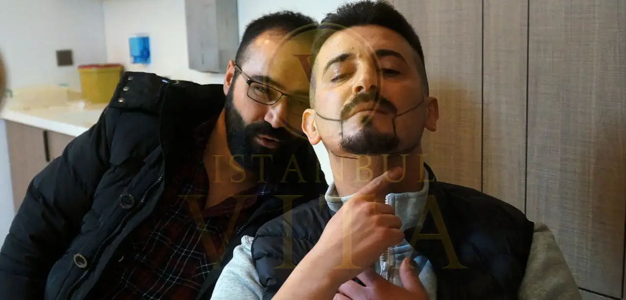 Greffe de barbe a Istanbul Vita