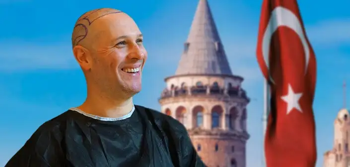 Greffe de Cheveux Turquie | Implant Capillaire à Istanbul