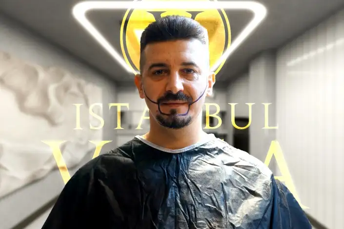 Greffe de Barbe et Moustache en Turquie - Prix 2024